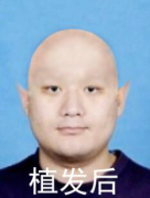 形態2